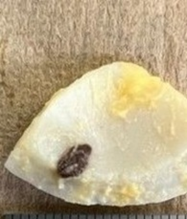 たまごサラダの中に黒い異物のようなものが入っていました